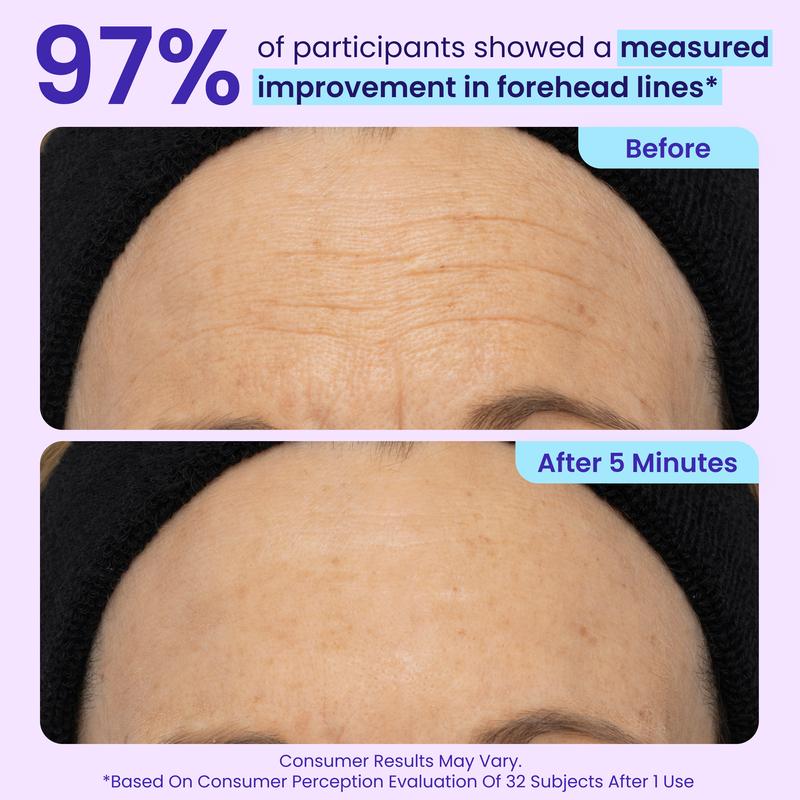 Final 3 Hours:60%OFF🔥 Instant Lift Eye Gel For Puffiness, Bags And Dark Circles