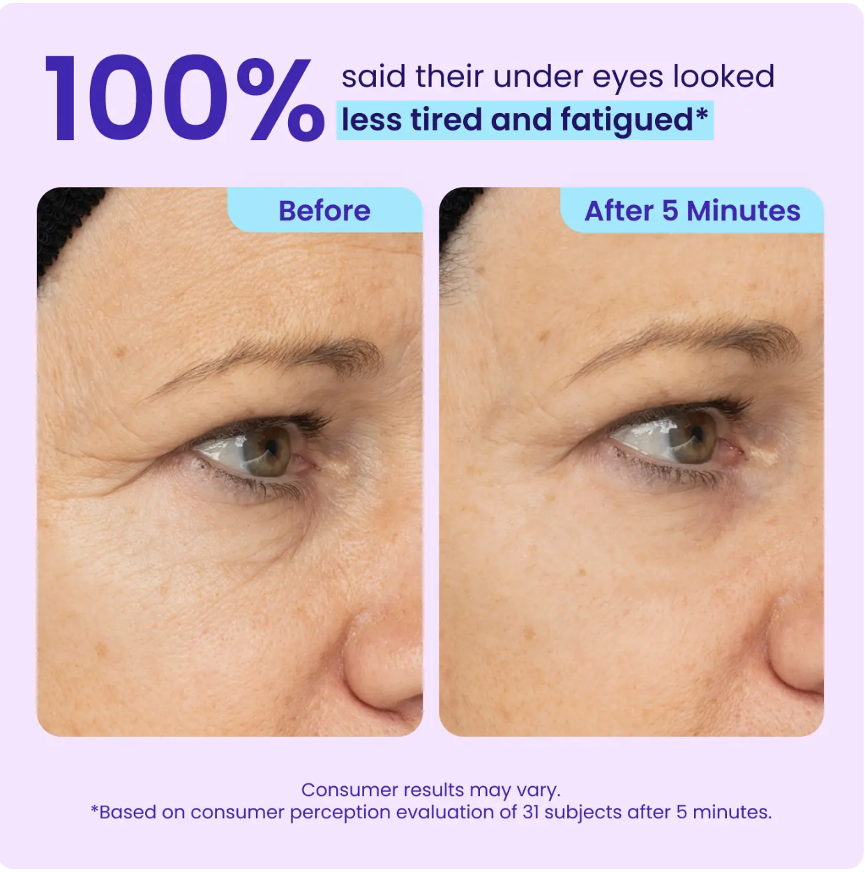 Final 3 Hours:60%OFF🔥 Instant Lift Eye Gel For Puffiness, Bags And Dark Circles