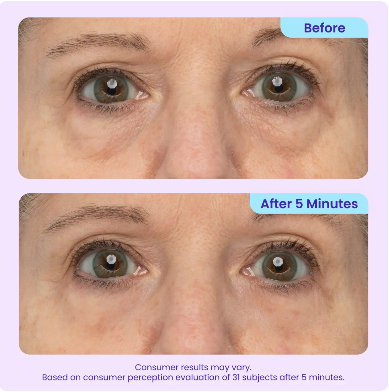 Final 3 Hours:60%OFF🔥 Instant Lift Eye Gel For Puffiness, Bags And Dark Circles